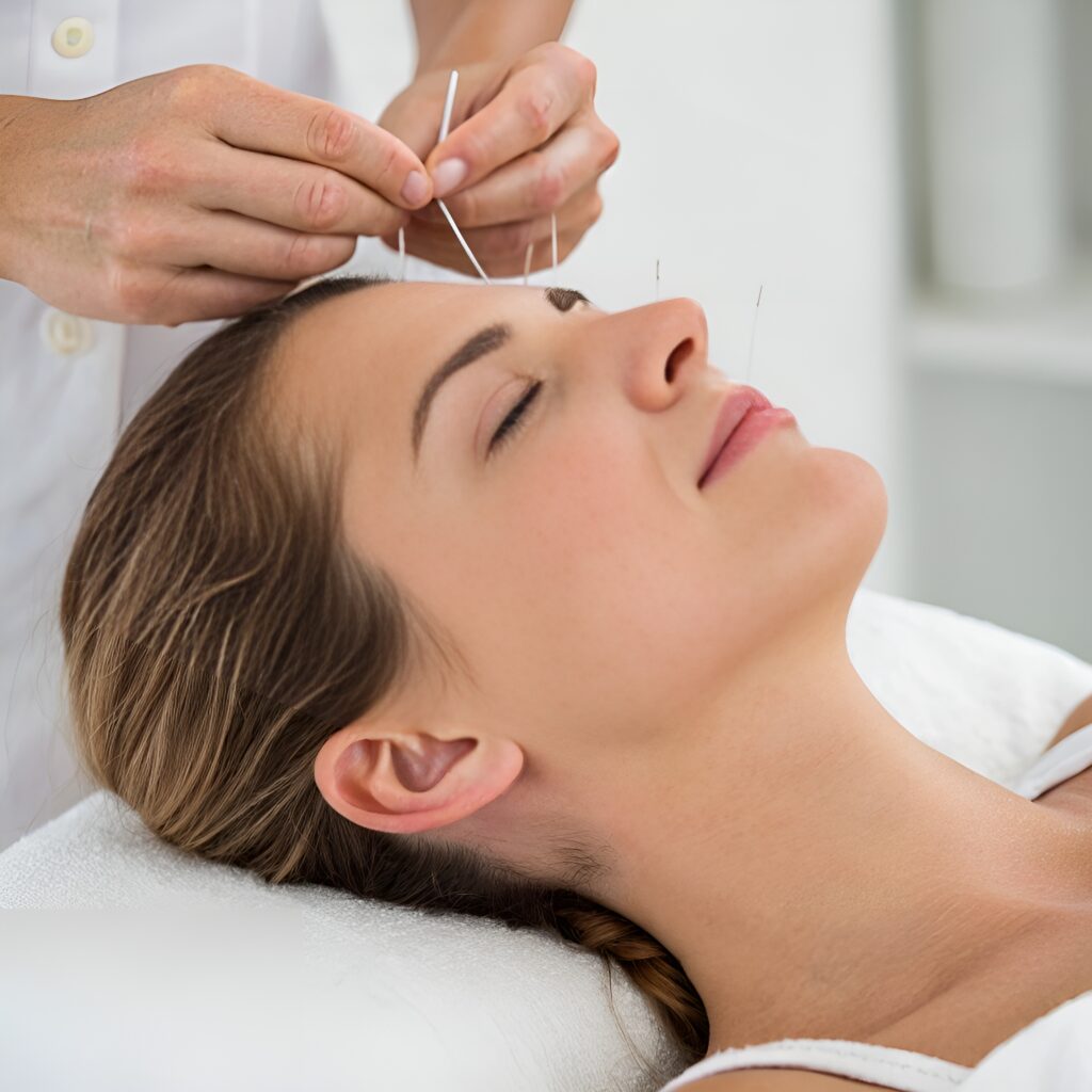 Facial Acupuncture Leicester