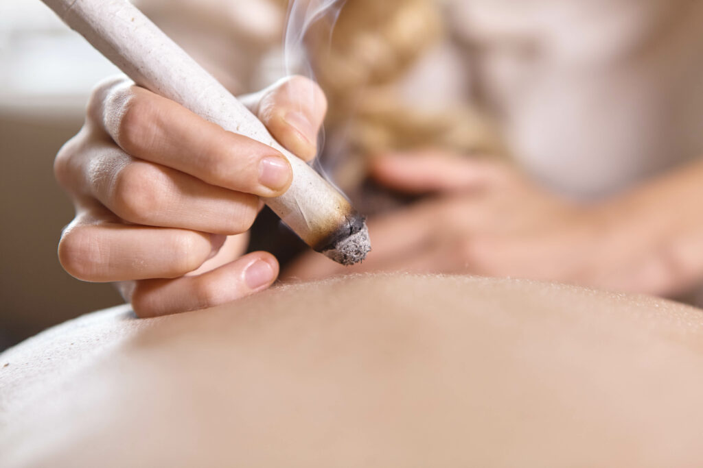 Moxibustion Leicester